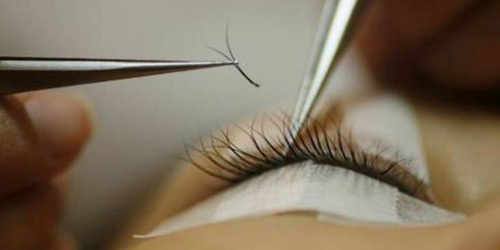 نجاح اول عملية زرع رموش لفتاة بريطانية!! نجاح اول عملية زرع رموش لفتاة بريطانية!!