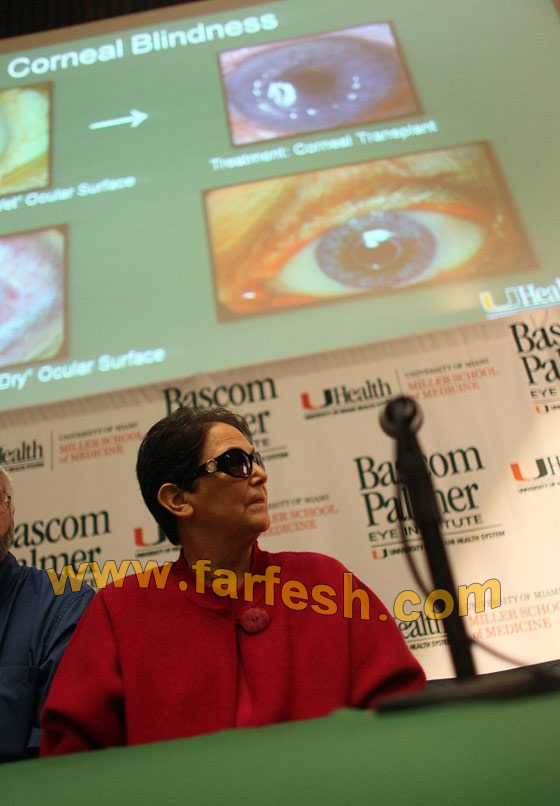 تستعيد بصرها بعد زراعة سن في عينها!!! تستعيد بصرها بعد زراعة سن في عينها!!!