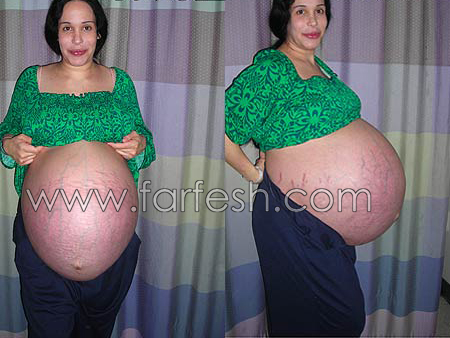 زوجان تونسيان بانتظار 12 مولودا ويتفوقان على الامريكية ذات الـ8