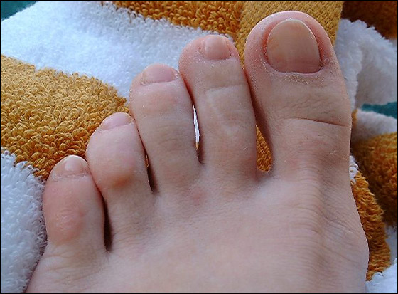 إليك من موقع شايف طريقة البديكير بالصور!!