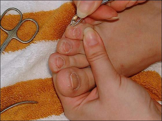 إليك من موقع شايف طريقة البديكير بالصور!!