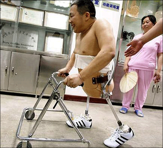 بعد استئصال نصفه افتتح متجر نصف رجل بنصف السعر!