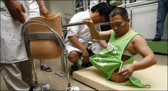 بعد استئصال نصفه افتتح متجر نصف رجل بنصف السعر!