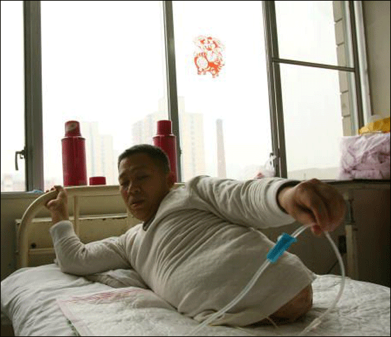 بعد استئصال نصفه افتتح متجر نصف رجل بنصف السعر!