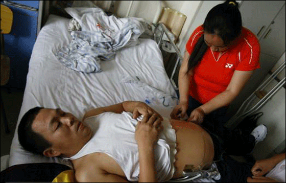 بعد استئصال نصفه افتتح متجر نصف رجل بنصف السعر!