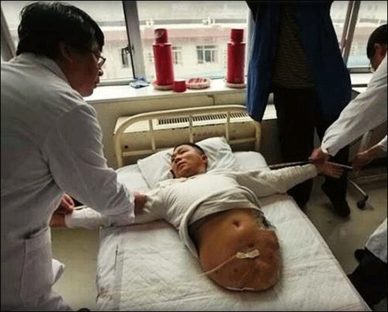 بعد استئصال نصفه افتتح متجر نصف رجل بنصف السعر!