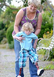 مؤثر جدا.. رحلة طفل بريطاني منذ قطع ساقيه حتى المشي مجددا