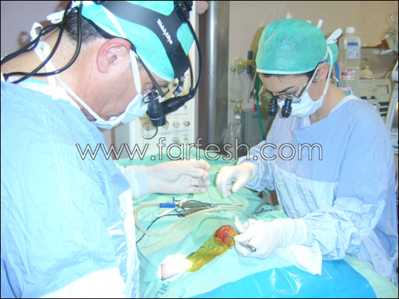 مستشفى الانجليزي:  ثلاث عمليات  قلب لخدج  بوزن اقل من  1 كغم