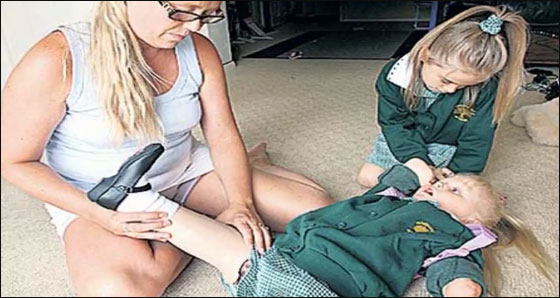 طفلة مبتورة الاطراف تساعد نظيرتها بالتاقلم مع وضعها الحالي