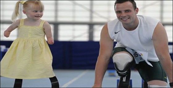 طفلة مبتورة الاطراف تساعد نظيرتها بالتاقلم مع وضعها الحالي