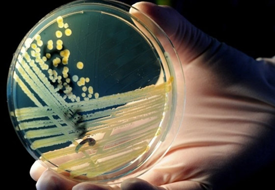 بكتيريا من نوع E.coli تنتشر بشكل خطير وتسبب وفيات