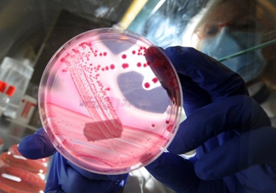 بكتيريا من نوع E.coli تنتشر بشكل خطير وتسبب وفيات