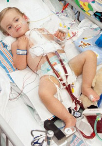 معجزة: طفل ينجو من فشل في القلب والرئة بسكتة قلبية!!