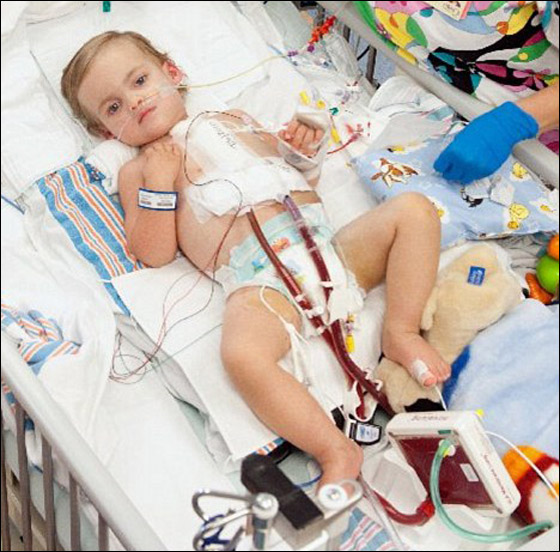 معجزة: طفل ينجو من فشل في القلب والرئة عقب جلطة دماغية!!