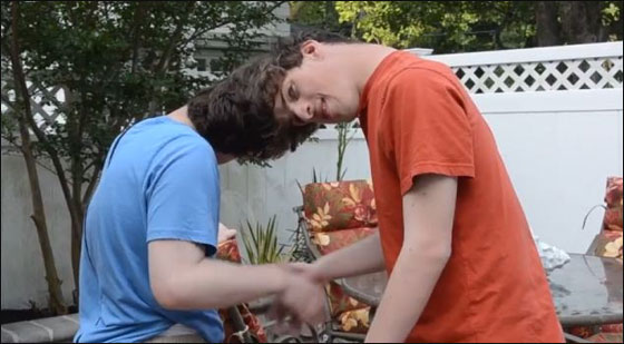 لاول مرة: توامان سياميان لا يريان بعضهما يرويان قصتهما 