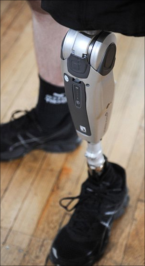 لاول مرة: ساق اصطناعية "مفكرة" تعمل من خلال احاسيس مستخدمها!