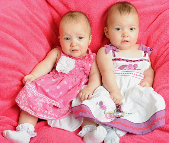 سبحان الله! ملاك حارس ينقذ جنينا ويساعده على الحياة ببطن أمه