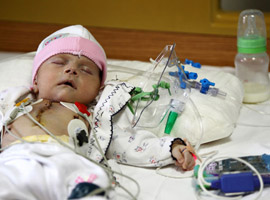 في حالة نادرة: طفلة تركية تنجو بعد ولادتها وقلبها خارج جسمها! 