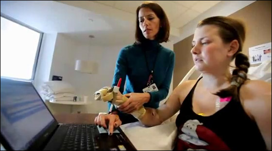 بالفيديو.. نجاح عملية زرع يدين لامرأة في الـ28 من العمر