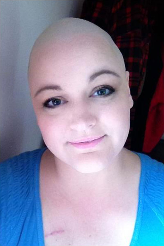 باربي صلعاء وجميلة.. حملة لدعم الاطفال المصابات بالسرطان!!