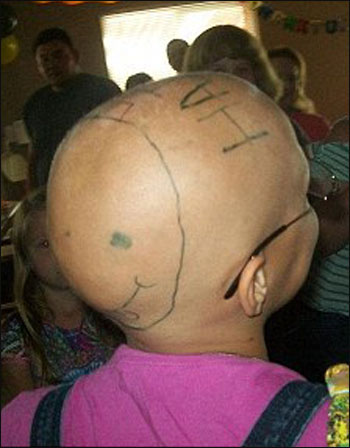 باربي صلعاء وجميلة.. حملة لدعم الاطفال المصابات بالسرطان!!