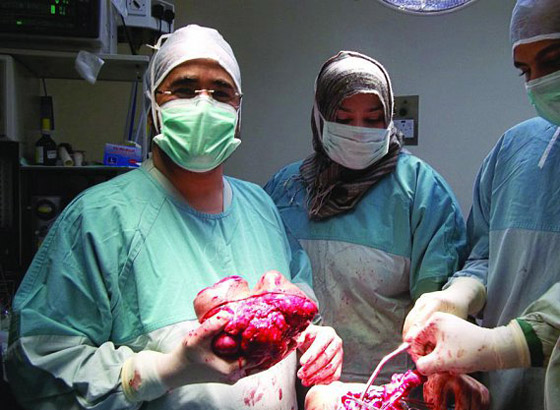 استئصال ورم يزن كيلو ونصف بنجاح من وجه امرأة سعودية!