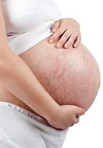 نقدم لك 8 طرق مهمة وسهلة للتخلص من تشقق الجلد المزعج!