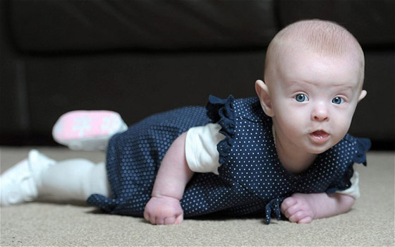 حالة طبية استثنائية.. طفلة تولد بدون دم وتنجو باعجوبة!