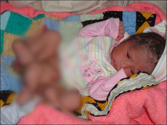 باكستان: ولادة رضيع بـ 6 أرجل وصحته جيدة!