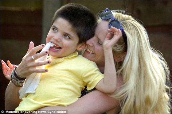 طفل في الخامسة من عمره مصاب بالتوحد ويتغذى على الستائر نتيجة خلل جيني