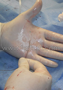 د. خالد سليمان يقتحم قلوب الناس من خلال اليد والفخذ!! 