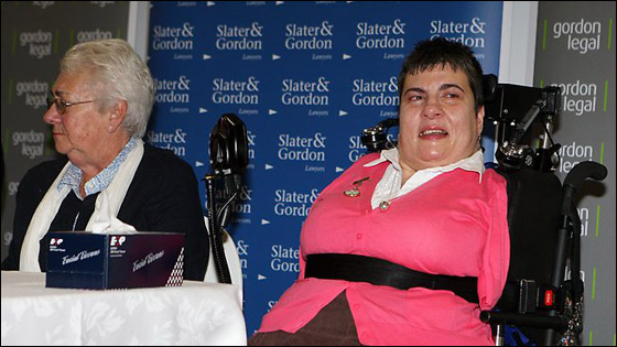 ملايين الدولارات تعويض لامراة ولدت دون اطراف بسبب عقار!