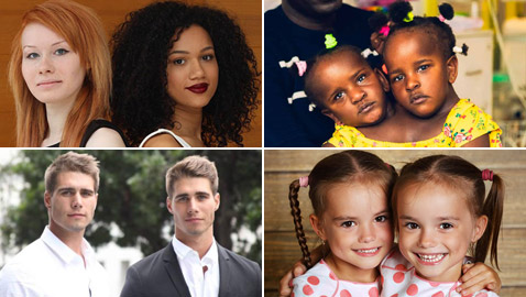 صور: تعرفوا إلى 6 من أغرب أنواع التوائم وأندرها في العالم